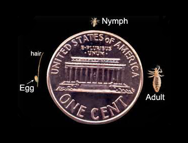 US ONE CENT- Head lice Life Cycle